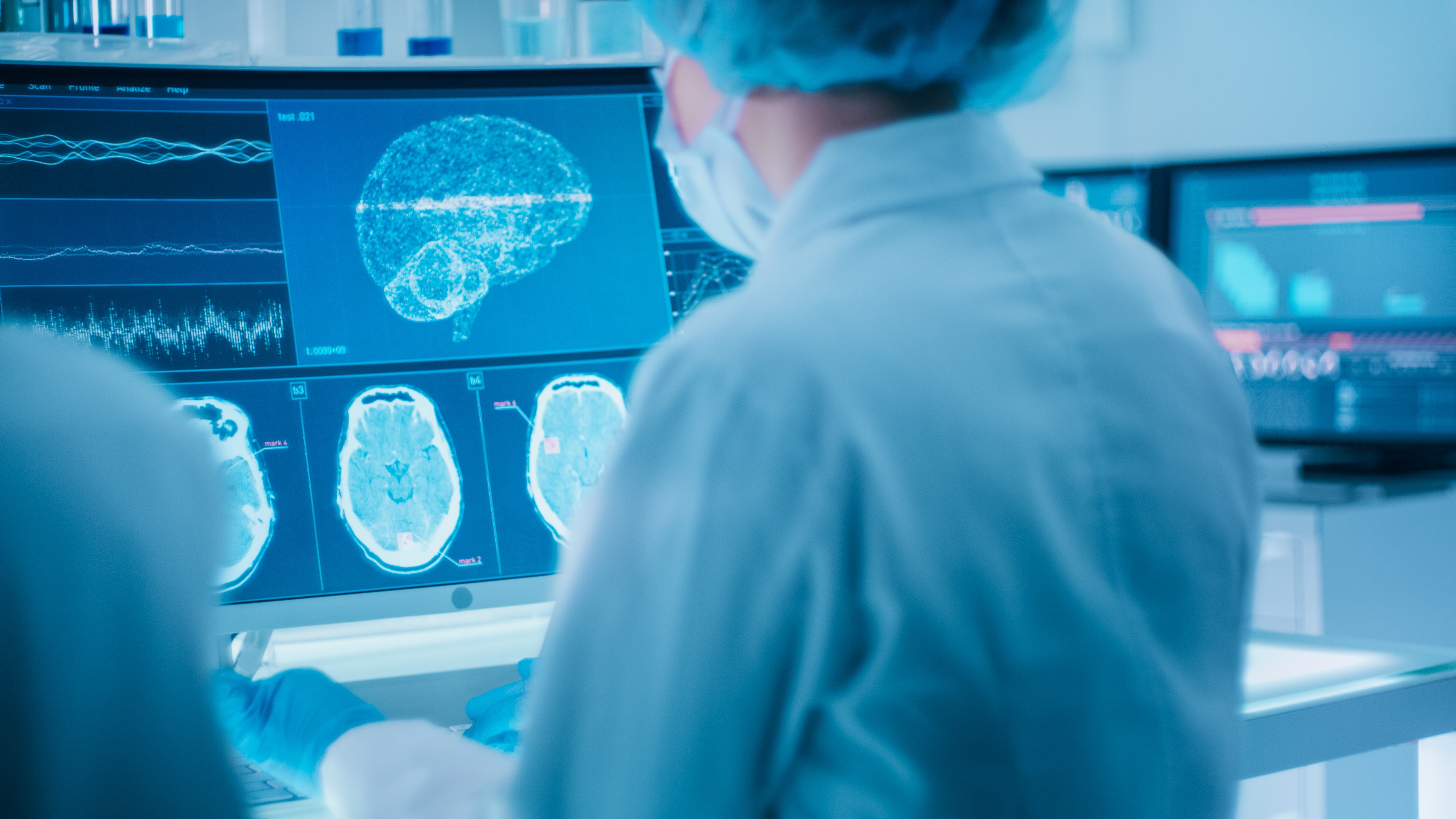 Medical negligence cancer misdiagnosis